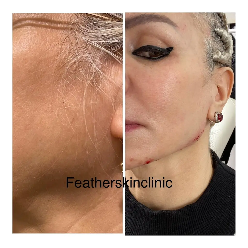 Feather Skin Clinic Photo