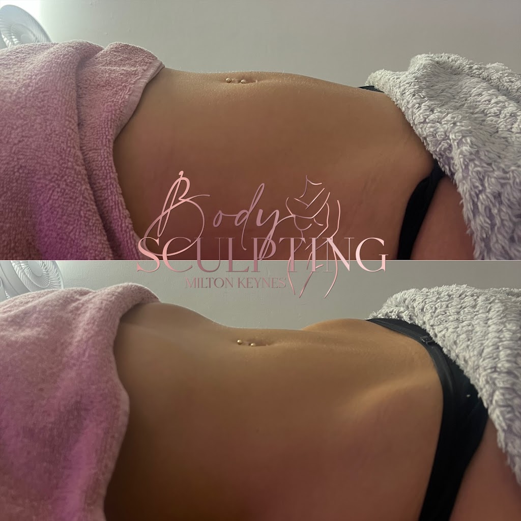 Body Sculpting Milton Keynes