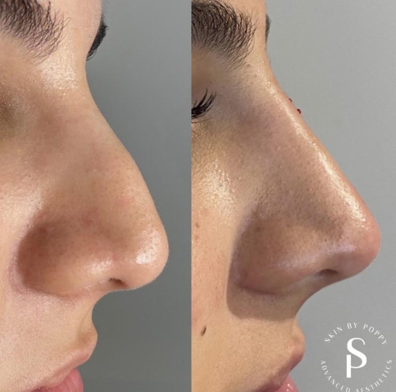 Skin By Poppy Milton Keynes