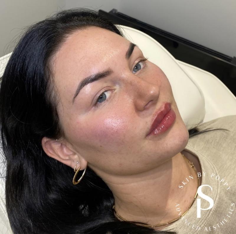 Skin By Poppy Milton Keynes