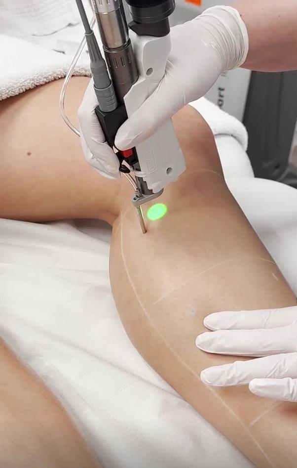 Eyo’s Laser Clinic