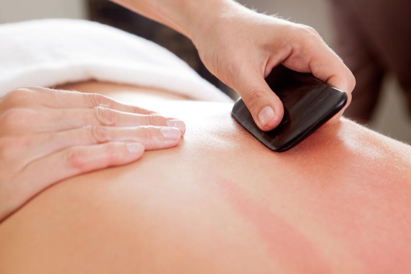 Harmony Acupuncture