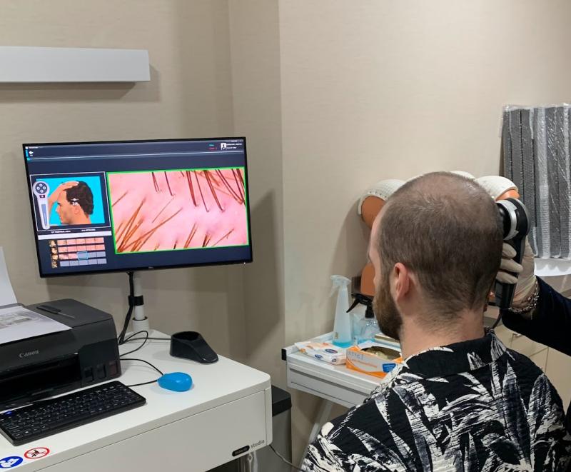 Capital Hair Restoration – Hair Transplant