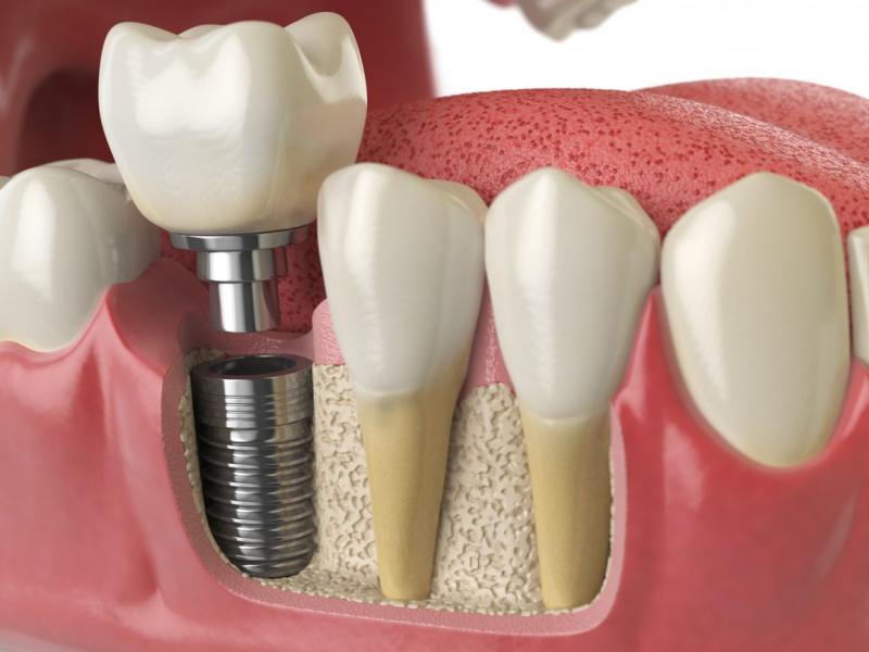 MK Dental Spa