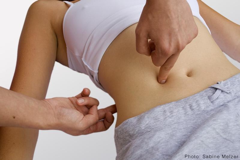 Neurological physiotherapist- Milton Keynes