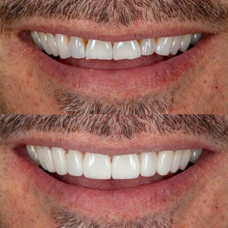 Smile Rooms Milton Keynes