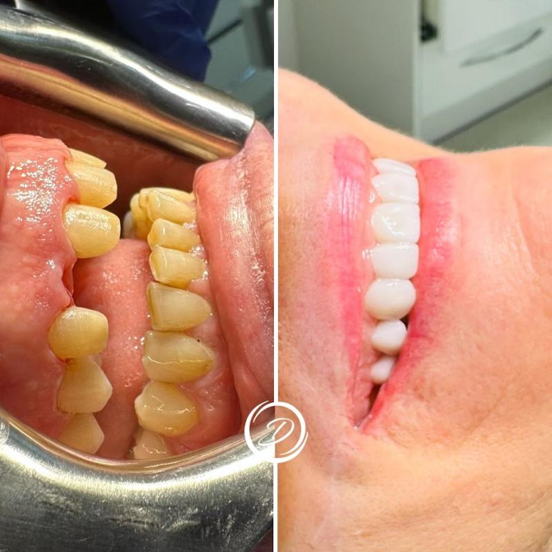 Diamond Dental MK