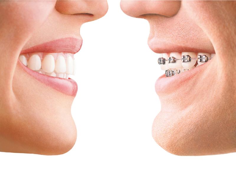 Teethinline Orthodontics