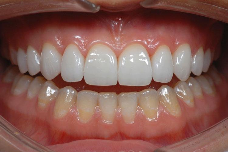 Mi Dental Stony